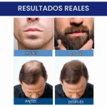 محلول رشد مجدد مو ماینوکسیدیل ۵٪ کرکلند برای آقایان | Kirkland Signature Minoxidil 5% Topical Solution for Men - تصویر 9